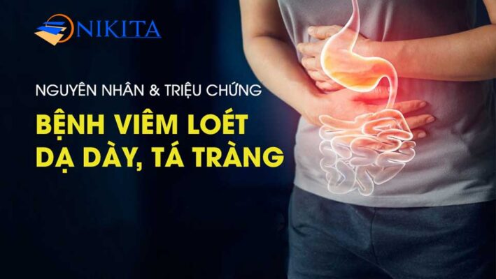 bệnh dạ dày tá tràng